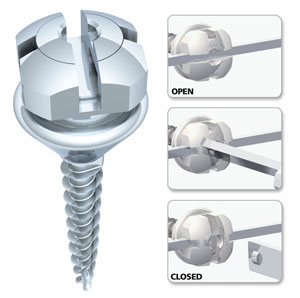 세라믹치과 치아교정일기 - 김여정 관련 이미지 7