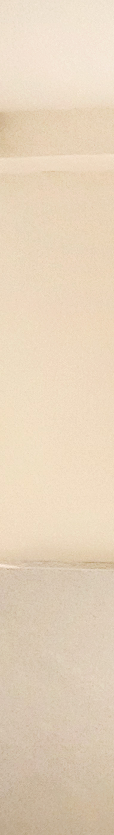 20대 돌출입교정, 무턱교정, 치아교정전후 세련된 얼굴 라인을 되찾다! 관련 이미지 13