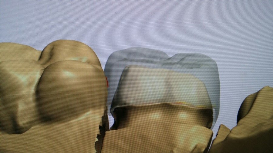 [미소가아름다운치과 양재유]  디지털 기공소 운영 관련 이미지 2