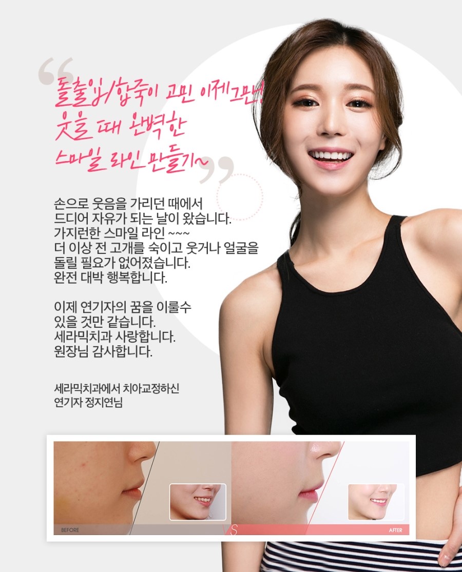 세라믹교정 이벤트 관련 이미지 10