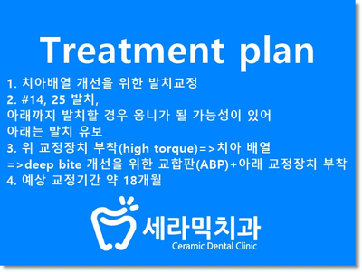 과개교합 치아교정잘하는곳, 세라믹치과 치아교정전후! 관련 이미지 18