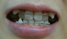 세라믹치과 드라큘라백작 에피소드 1 관련 이미지 1