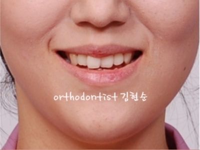 강남교정치과 관련 이미지 36