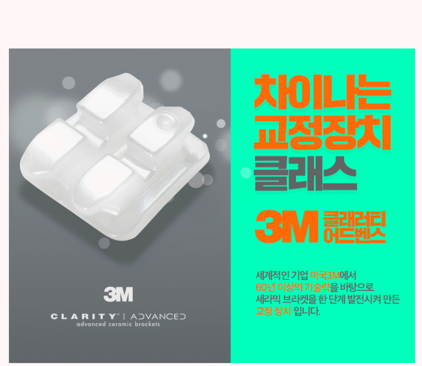 세라믹치과 3M 클래러티 어드밴스 치아교정 전속모델 콘테스트 관련 이미지 3