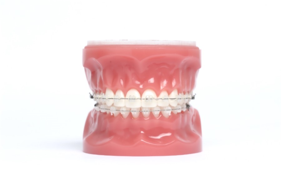 학동역치과 치아교정 잘하는 곳 ! 관련 이미지 3