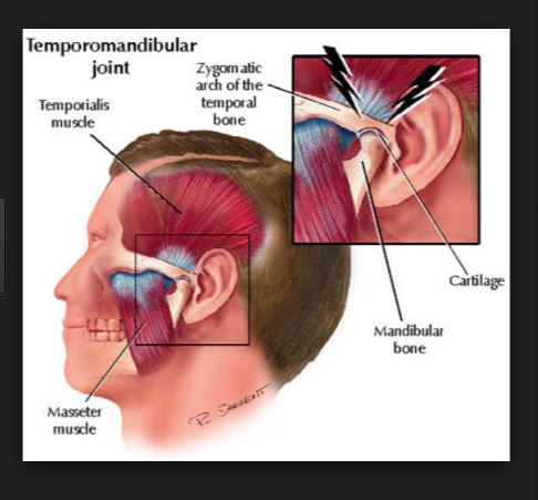 치아교정 부작용 턱관절 통증 관련 이미지 2