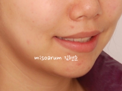 강남치아교정추천 관련 이미지 39