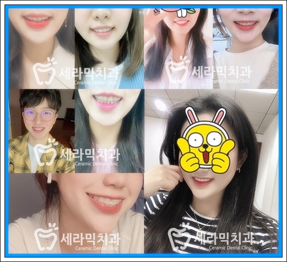 성인교정, 40대 50대 치아교정 잘하는 세라믹치과 치아교정전후 관련 이미지 9