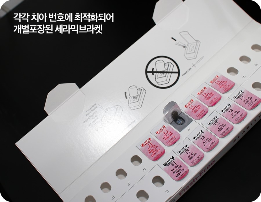 치아각도 교정과정 관련 이미지 3