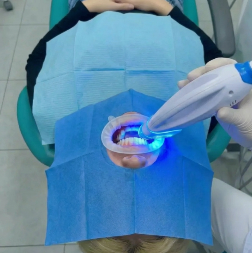 치아미백, 전문가 치아미백? 홈미백? 셀프미백? 총정리 관련 이미지 3