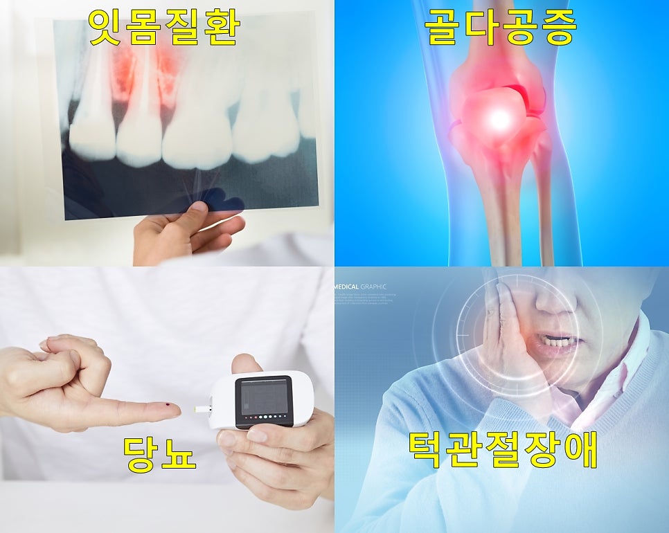 성인교정, 40대 50대 치아교정 잘하는 세라믹치과 치아교정전후 관련 이미지 3