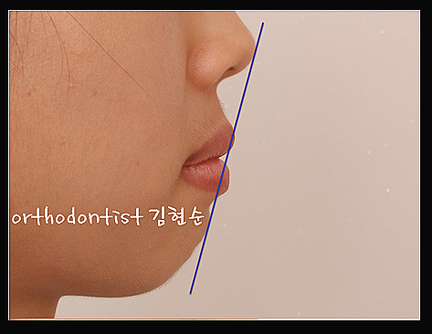 강남교정치과 관련 이미지 37