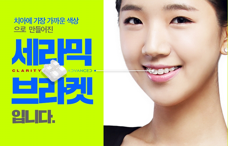 세라믹치과 돌출입교정은 미국3M 치아교정으로 관련 이미지 7