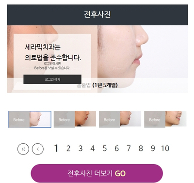 강남 세라믹 치아교정 잘하는곳, 세라믹치과 관련 이미지 7