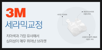 세라믹교정 잘하는 곳은? 세라믹치과 관련 이미지 6
