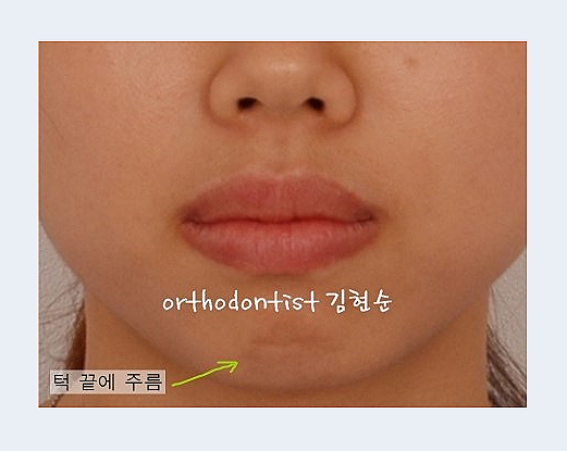 강남교정치과 관련 이미지 3