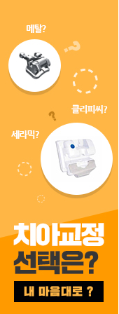 돌출입 교정 실패 그 후 ~ 관련 이미지 8
