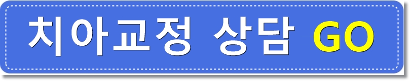 발치없이 치열불규칙교정으로 세련된 미소 완성! 관련 이미지 6