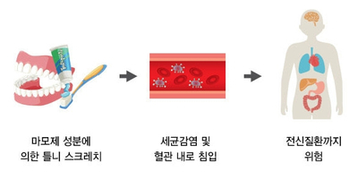 치아교정 유지장치와 틀니, 제대로 관리하는 법! 관련 이미지 5