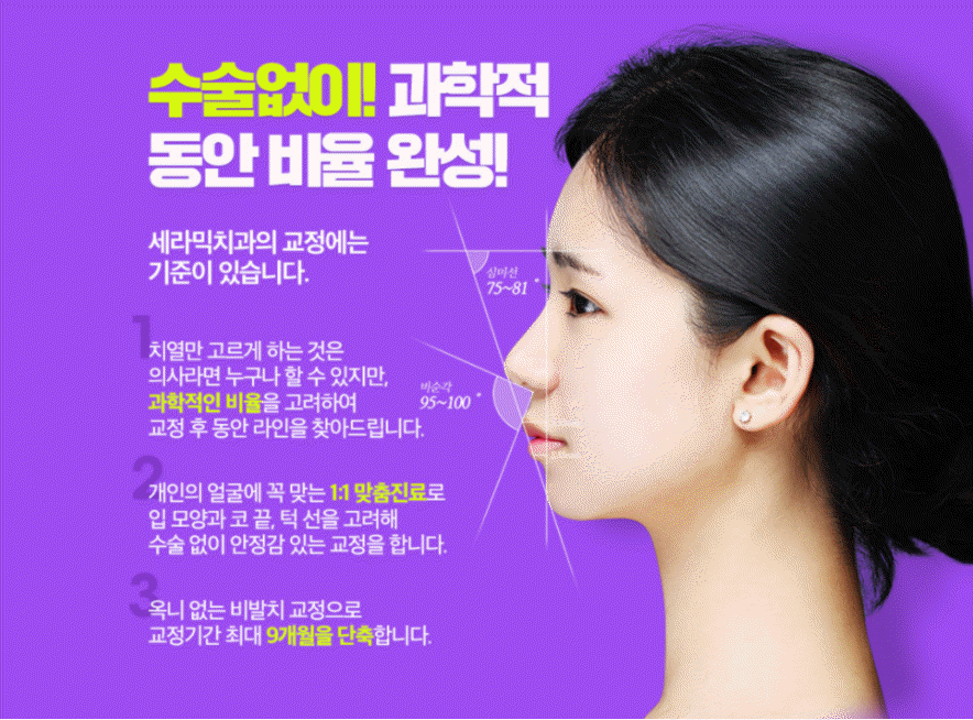 세라믹치과 3M 클래러티 어드밴스 치아교정 전속모델 콘테스트 관련 이미지 14