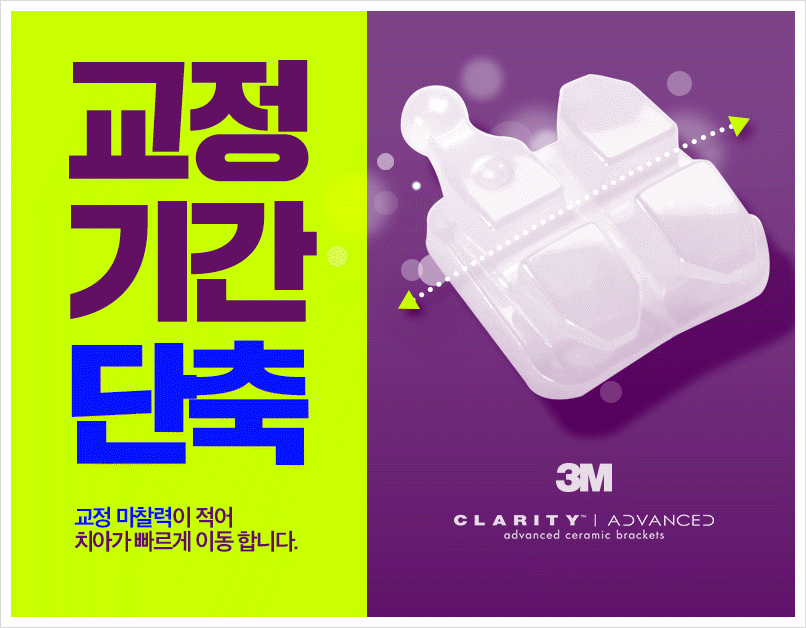 세라믹교정 단점을 보안한 클래러티 어드밴스 ~ 관련 이미지 6