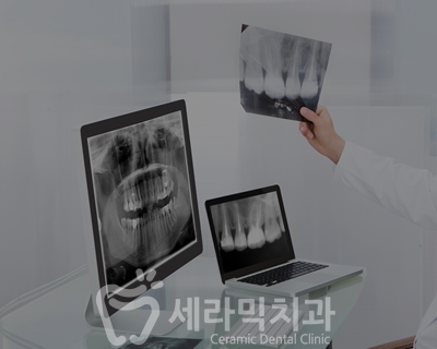 치아교정 부작용, 결과 불만족 고민 해결사, 세라믹치과 관련 이미지 5