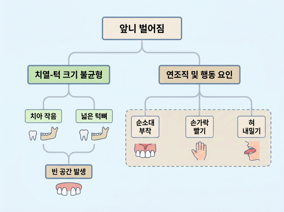 앞니 벌어짐 치료 방법 비교: 교정·레진·라미네이트 관련 이미지 2