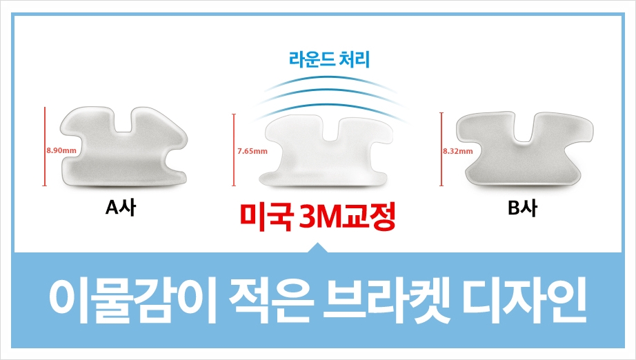 세라믹교정 단점을 보안한 클래러티 어드밴스 ~ 관련 이미지 3