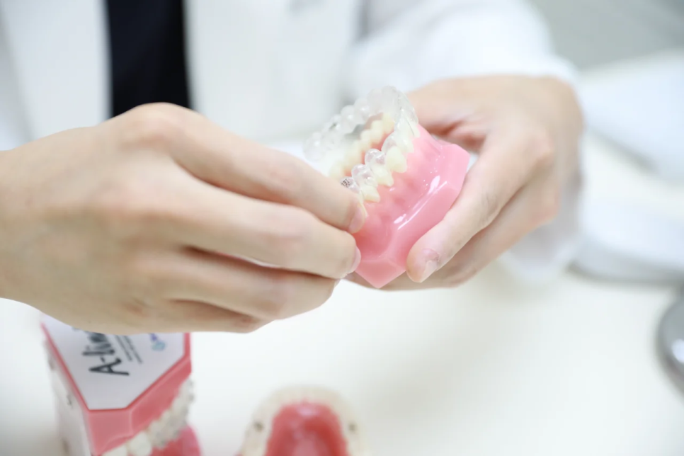 덧니 교정, 꼭 발치가 필요할까요? 비발치가 가능한 조건 관련 이미지 2