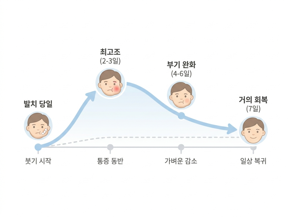 Swelling After Extraction for Orthodontic Treatment—How Many Days Is Normal? Progress Over Time and Ways to Reduce It Quickly image 3