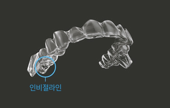 How to Choose an Orthodontic Appliance Without Regret image 9