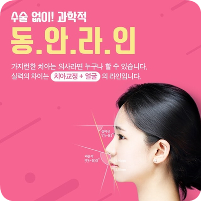 반대교합 관련 이미지 10