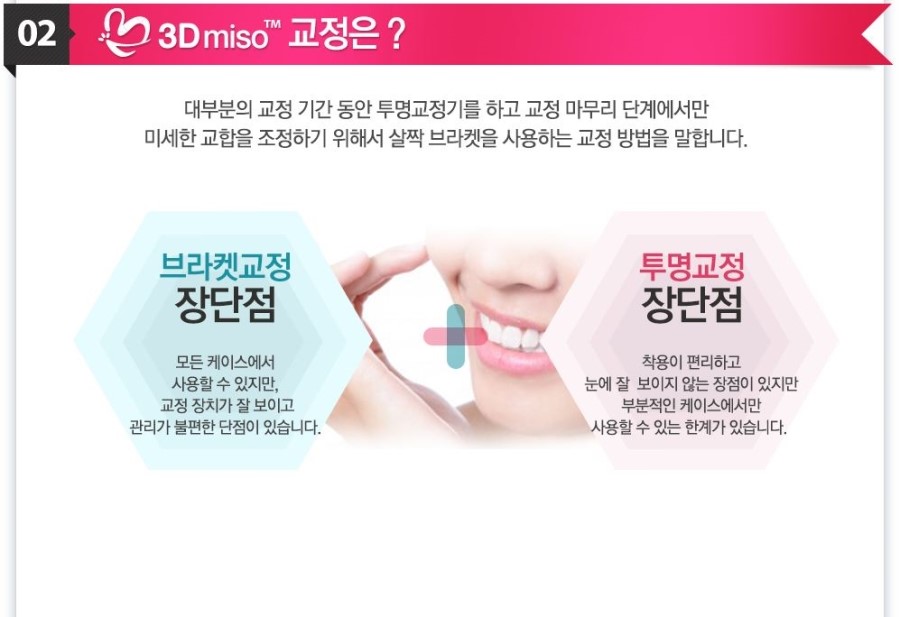 [ 학동역 치과 ] 투명교정의 새이름 3D miso 교정 관련 이미지 4