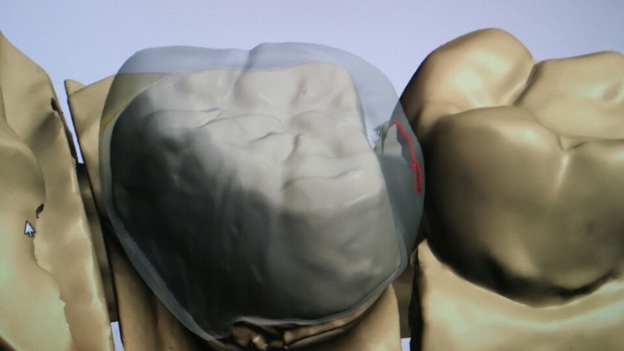 [미소가아름다운치과 양재유]  디지털 기공소 운영 관련 이미지 15