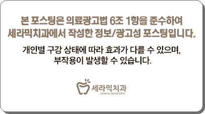 벌어진 앞니, 최소삭제 라미네이트 전후 관련 이미지 7