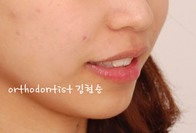 강남 돌출 관련 이미지 33