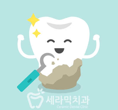 치아교정 부작용 3. 치아 사이 틈(블랙트라이앵글) 관련 이미지 6