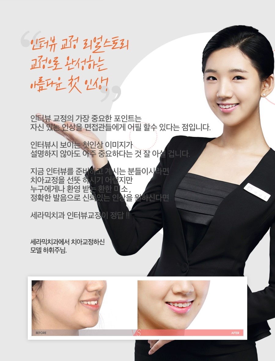 세라믹교정 이벤트 관련 이미지 12