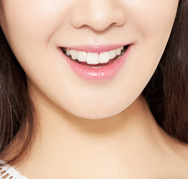 세투교정은 세라믹투명교정 ~ 관련 이미지 1