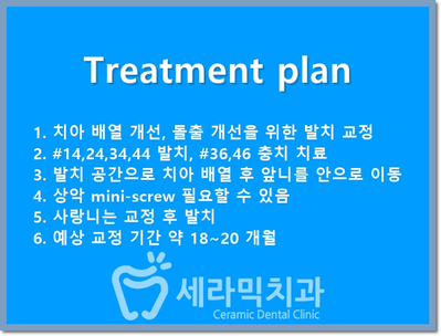 돌출입 덧니 비대칭 치아교정 전후 인상변화! 관련 이미지 12