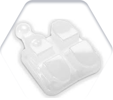 학동역교정치과 세라믹치과 세라믹교정 관련 이미지 3