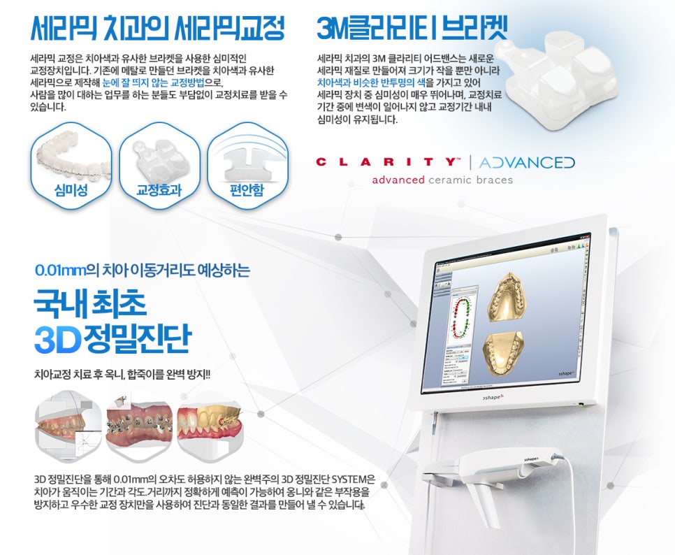 강남치아교정 브라켓비교분석 관련 이미지 24