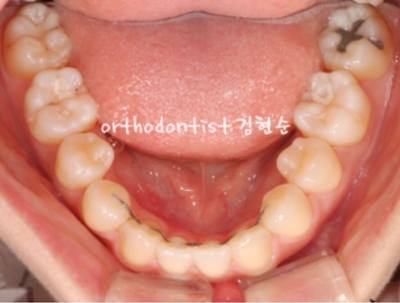 강남교정치과 관련 이미지 23