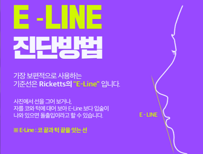 강남 돌출 관련 이미지 5