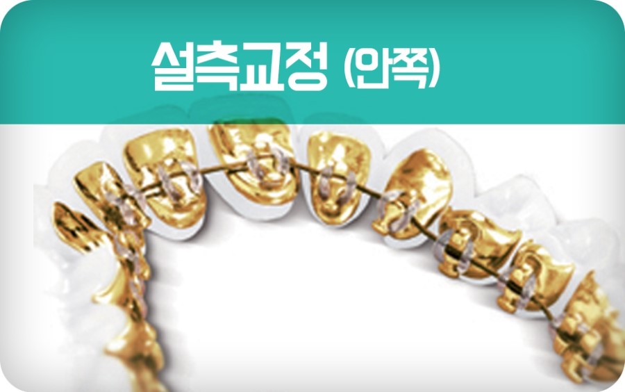 교정장치 구분하기 관련 이미지 15