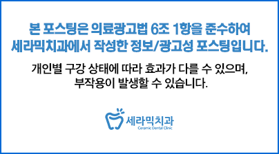 치아교정전후 : 돌출입, 무턱, 개방교합, 거미스마일을 한번에 해결! 관련 이미지 4