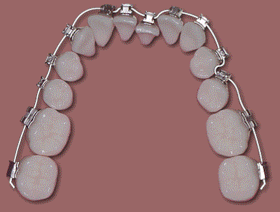 클리피씨 비용 기간단축 관련 이미지 4