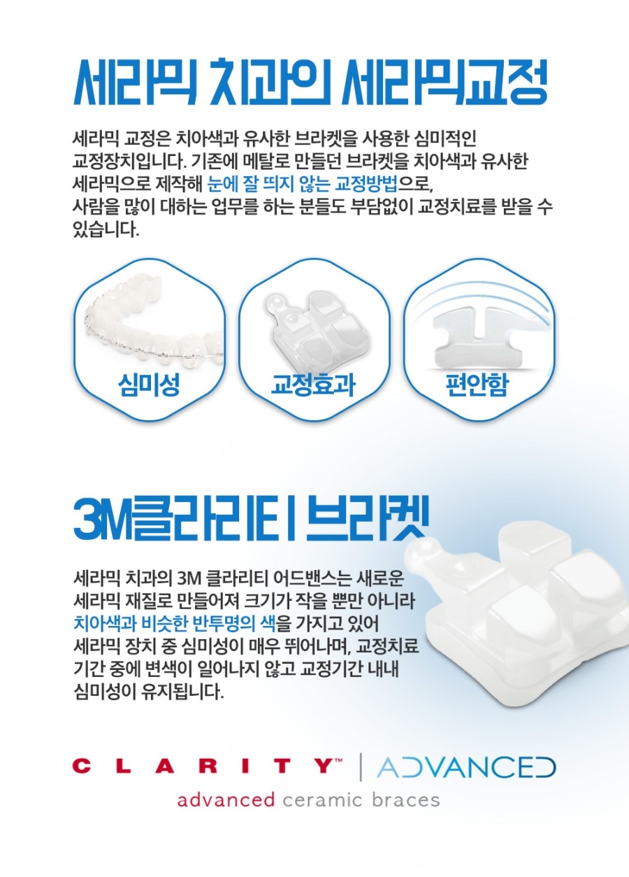 세라믹교정 이벤트 관련 이미지 3