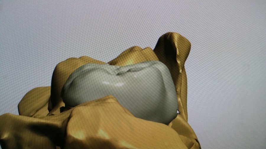 [미소가아름다운치과 양재유]  디지털 기공소 운영 관련 이미지 10