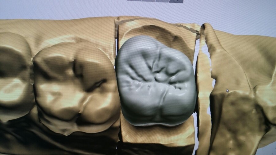 [미소가아름다운치과 양재유]  디지털 기공소 운영 관련 이미지 4